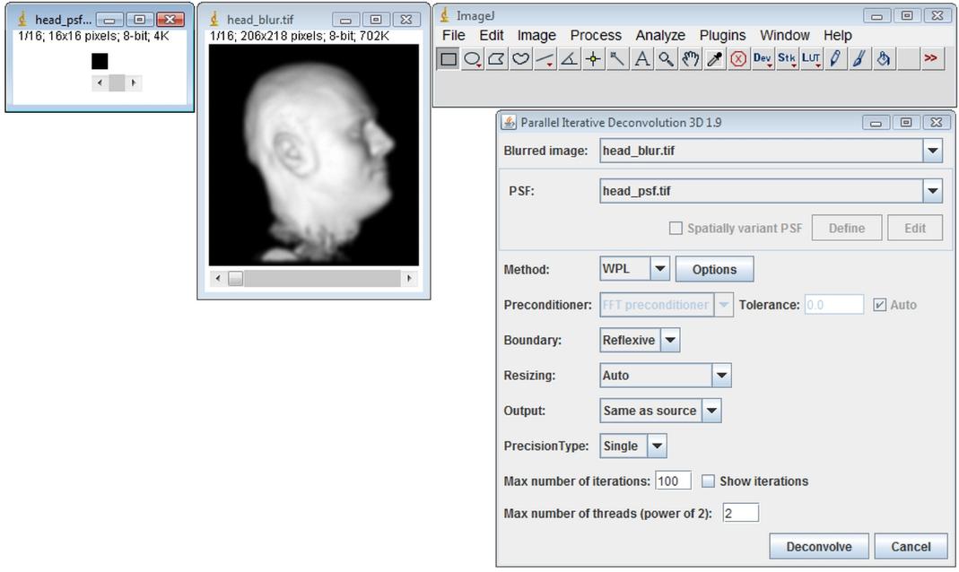 ParallelIterativeDeconvolution3DSpatiallyInvariantExample1.jpg