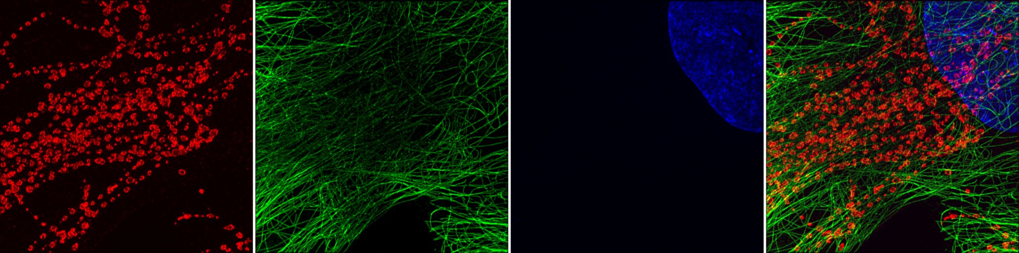 3 channels image, in Red Green Blue and Merge.