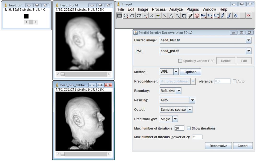 ParallelIterativeDeconvolution3DSpatiallyInvariantExample3.jpg