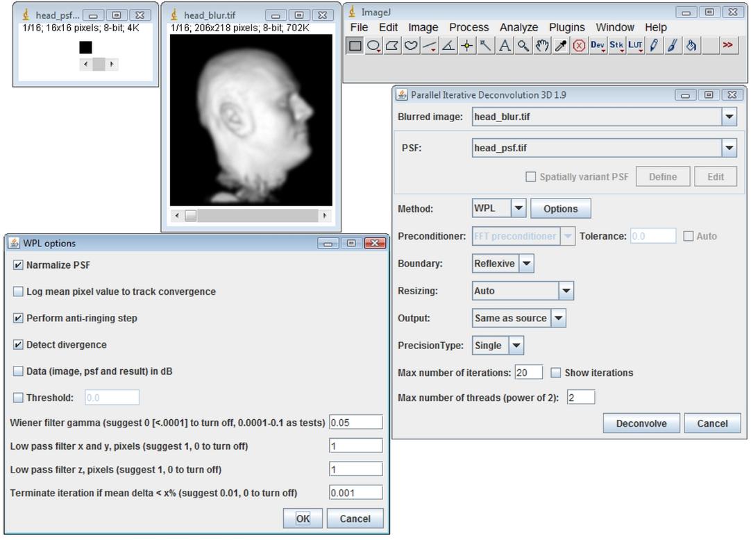 ParallelIterativeDeconvolution3DSpatiallyInvariantExample2.jpg