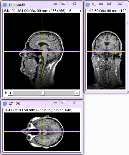 orthogonal_views_example.png