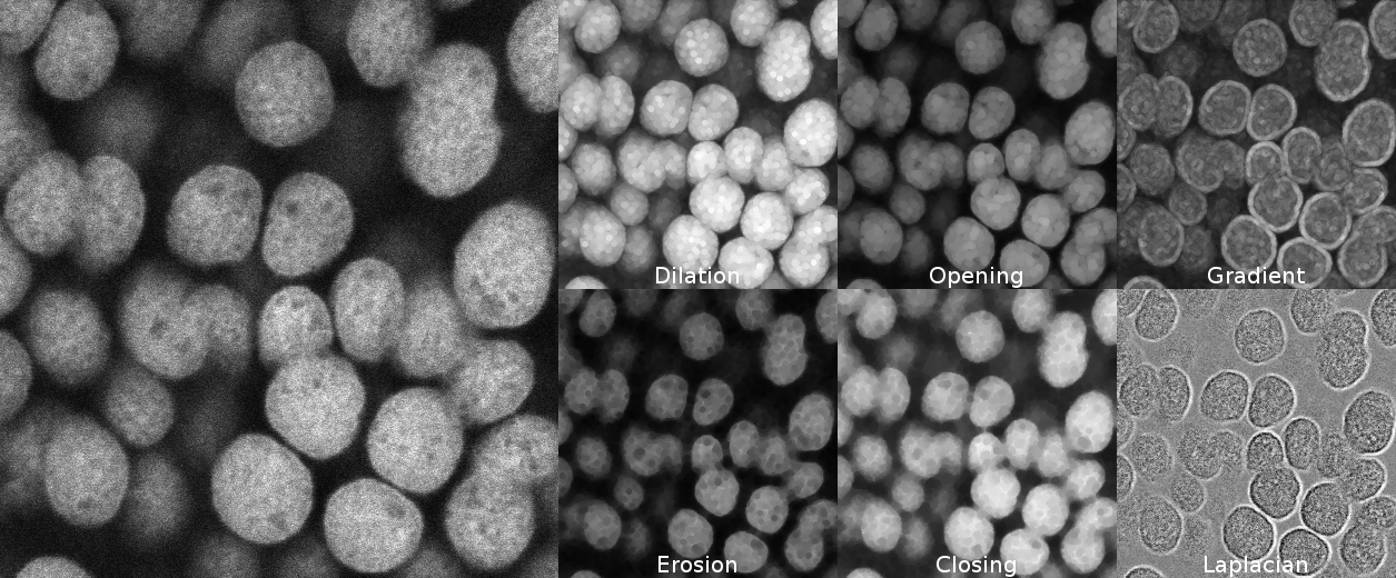 MorphoLibJ filter examples: DAPI stained nuclei image and the result of applying different morphological filters with an octagon of radius 5 as structuring element.