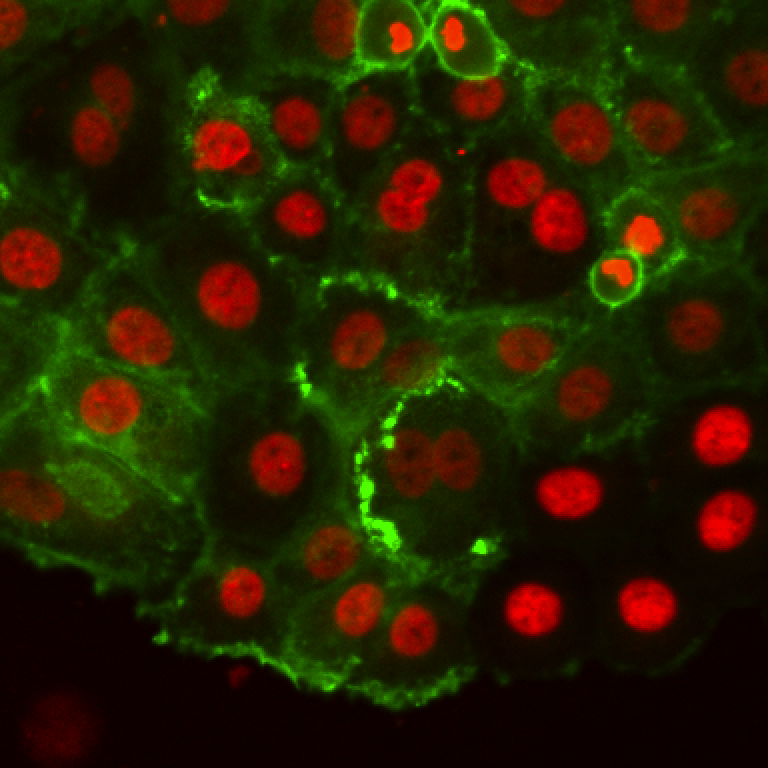 /media/plugins/trackmate/detectors/cellpose/trackmate-cellpose-tutorial-01