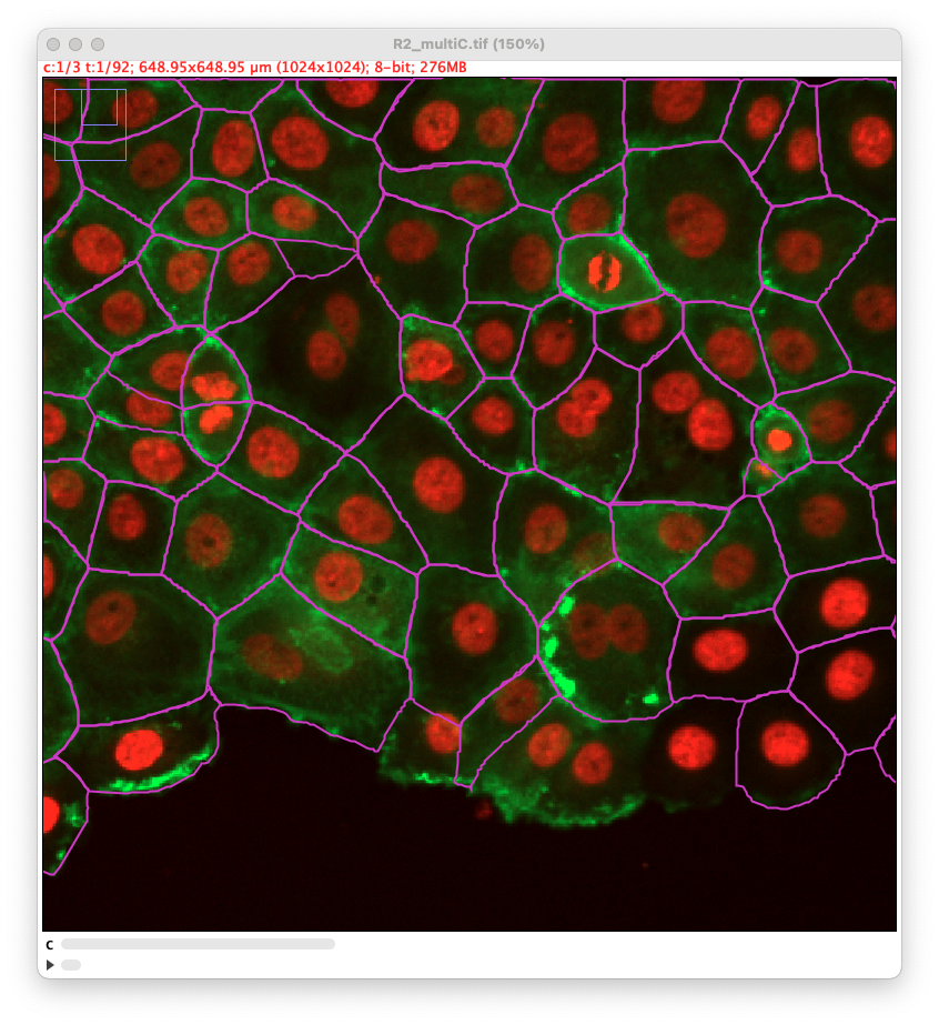 /media/plugins/trackmate/detectors/trackmate-cellpose-sam-channel-2.png