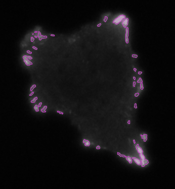 /media/plugins/trackmate/detectors/trackmate-weka-detector-image6.gif