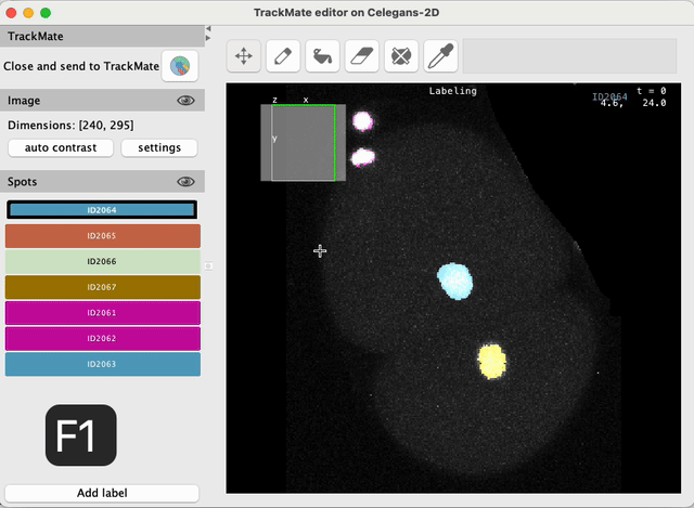 /media/plugins/trackmate/spot-editor/trackmate-spot-editor-tuto-16.gif